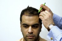 Turkeys medical tourism sector can be hair raising (c) Murad Sezer Reuters